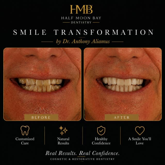 Before and after cosmetic smile transformation by Dr. Anthony Aliamus