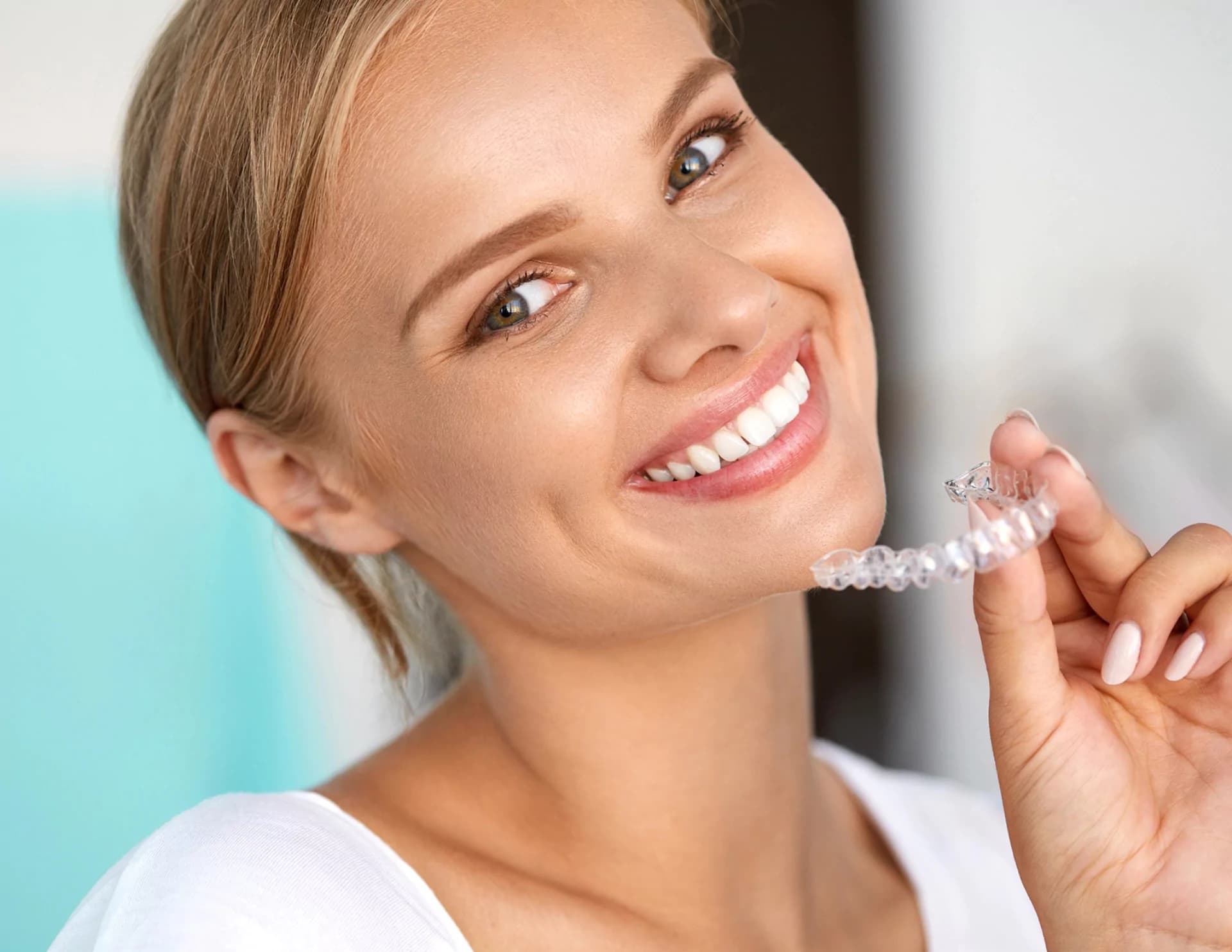 Invisalign Aligners